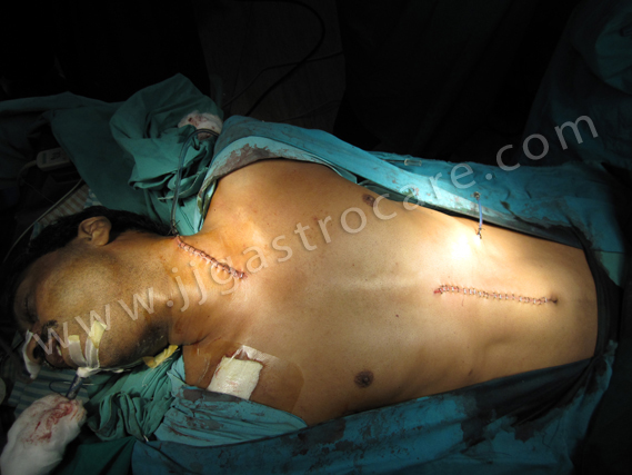 Dr Joshy John. Senior gastrointestinal surgeon